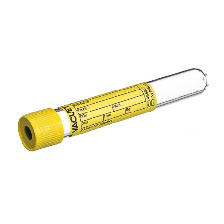 Probówka Vacuette do analizy moczu Pull Cap 10ml, Greiner, 50szt./op.